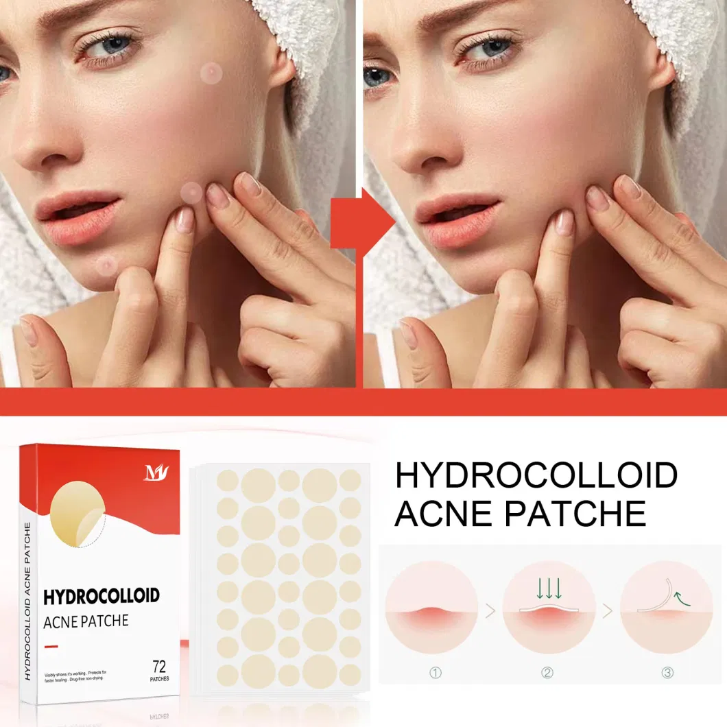 OEM Acne Skin Care 72 Patches Waterproof Hydrocolloid Acne Pimple Absorbing Cover&Blemish Spot