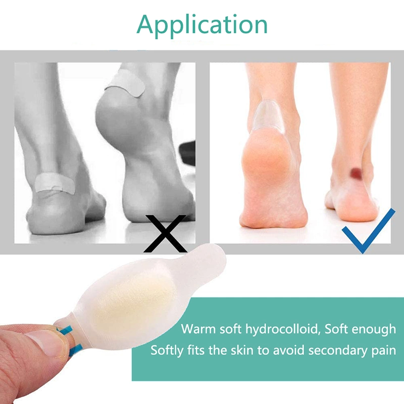 Bluenjoy Medical Acne Patch Hydrocolloid Foot Blister Plaster