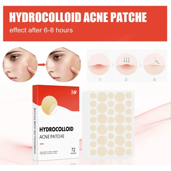 OEM Acne Skin Care 72 Patches Waterproof Hydrocolloid Acne Pimple Absorbing Cover&Blemish Spot